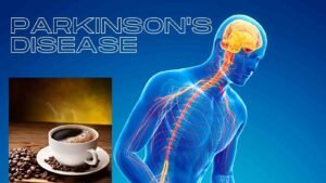 Find out the relation between coffee and Parkinson’s Disease