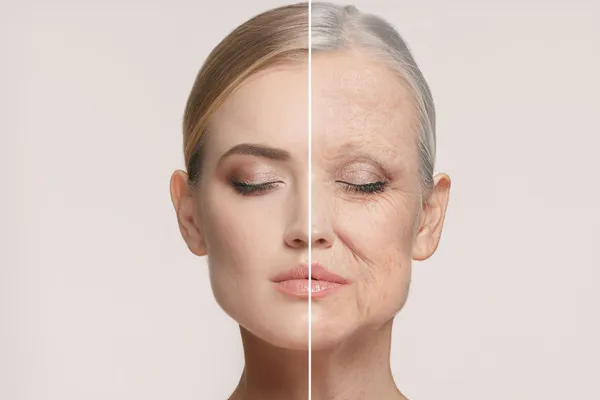 Understanding Wrinkles: Causes, Sleep Impacts, and Prevention Strategies for Youthful Skin